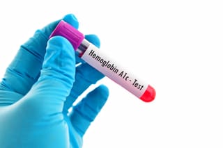 Image of A1C blood test in a blood collection tube